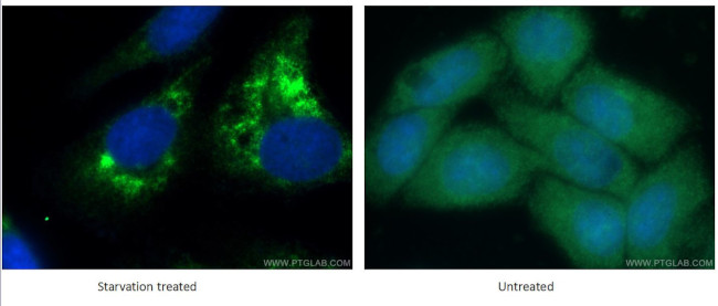 LC3B Antibody in Immunocytochemistry (ICC/IF)