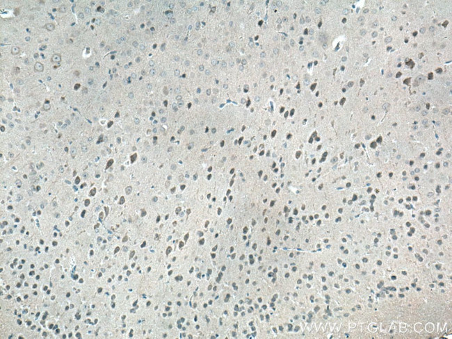 LC3B Antibody in Immunohistochemistry (Paraffin) (IHC (P))