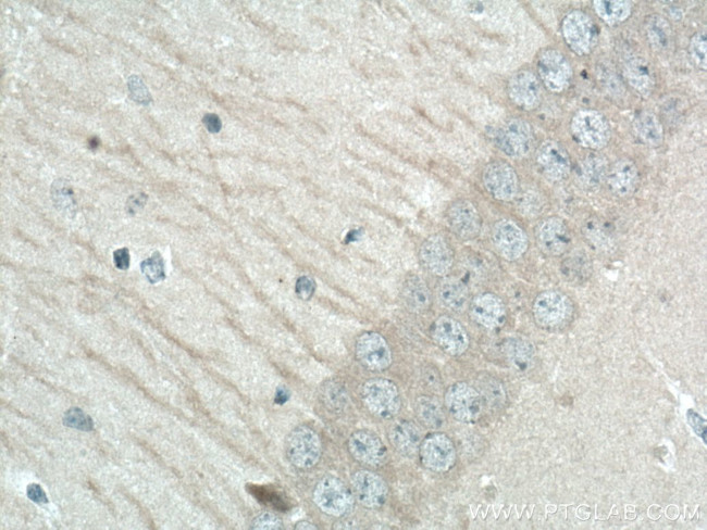 LC3B Antibody in Immunohistochemistry (Paraffin) (IHC (P))