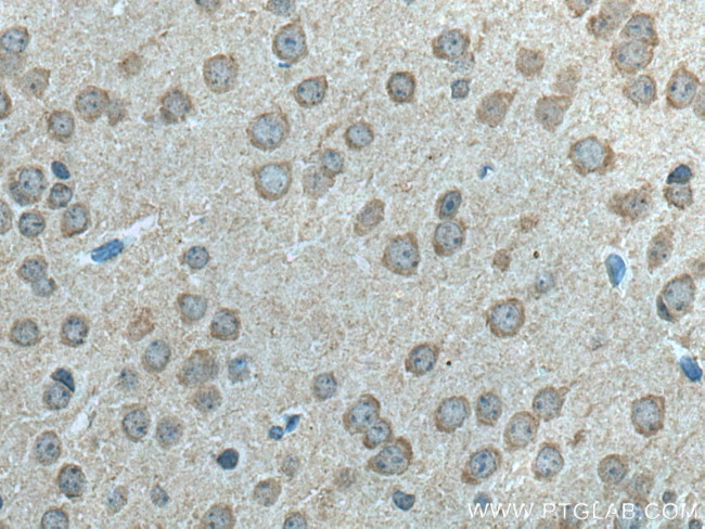 LC3B Antibody in Immunohistochemistry (Paraffin) (IHC (P))