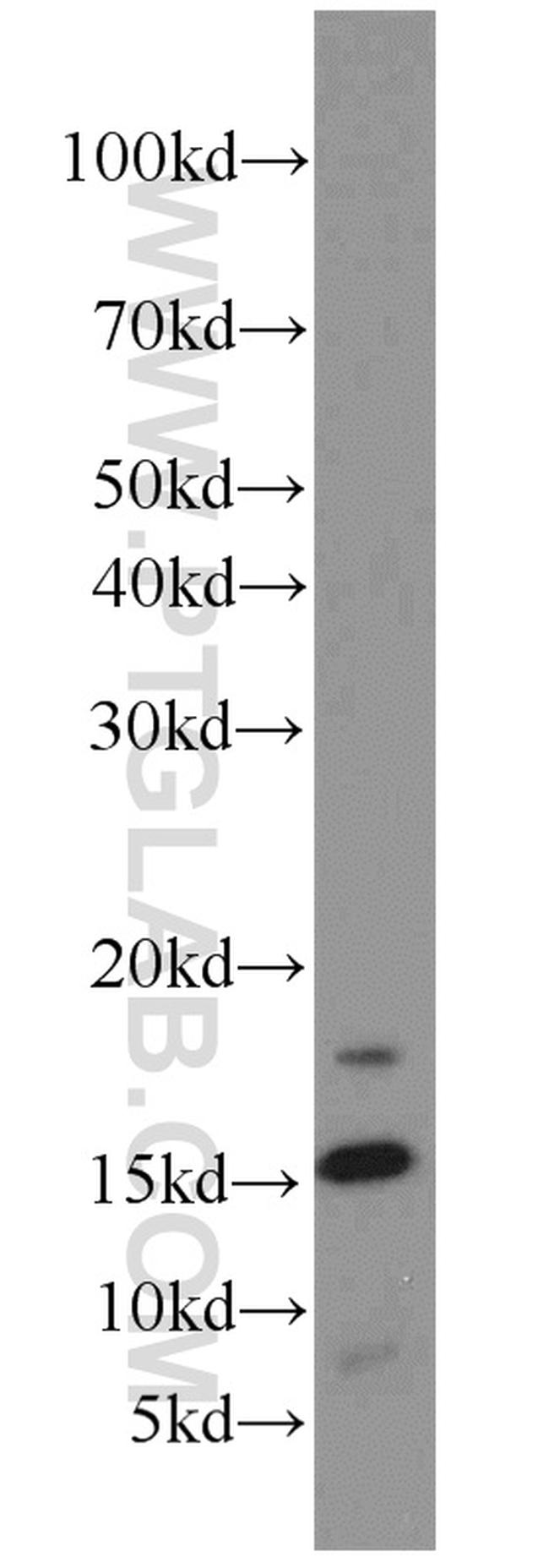 LC3B Antibody in Western Blot (WB)