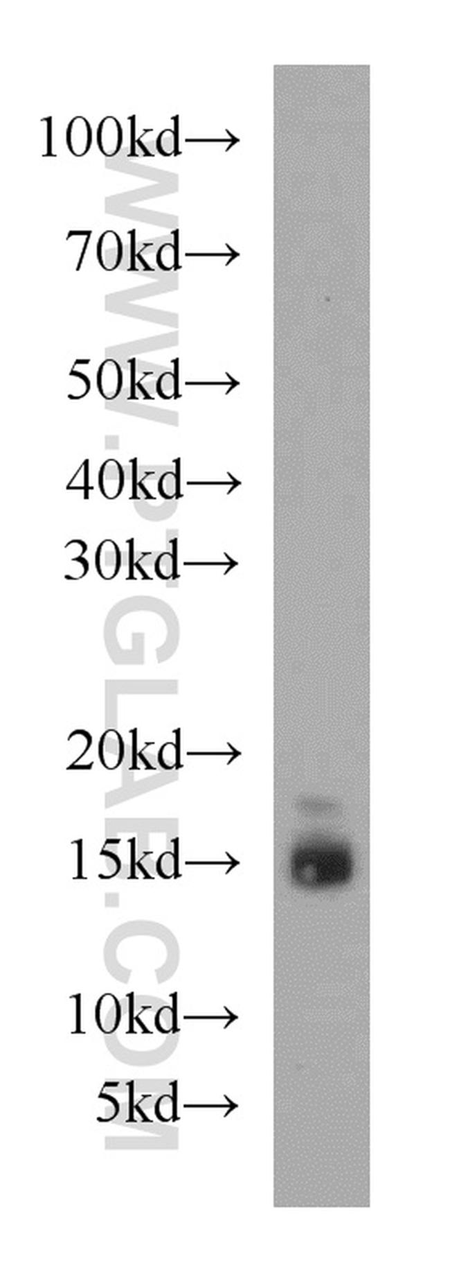 LC3B Antibody in Western Blot (WB)