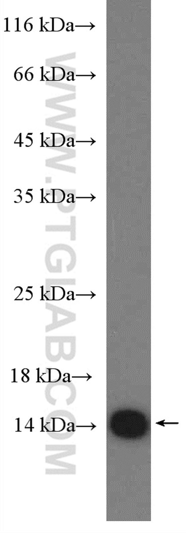 LC3B Antibody in Western Blot (WB)