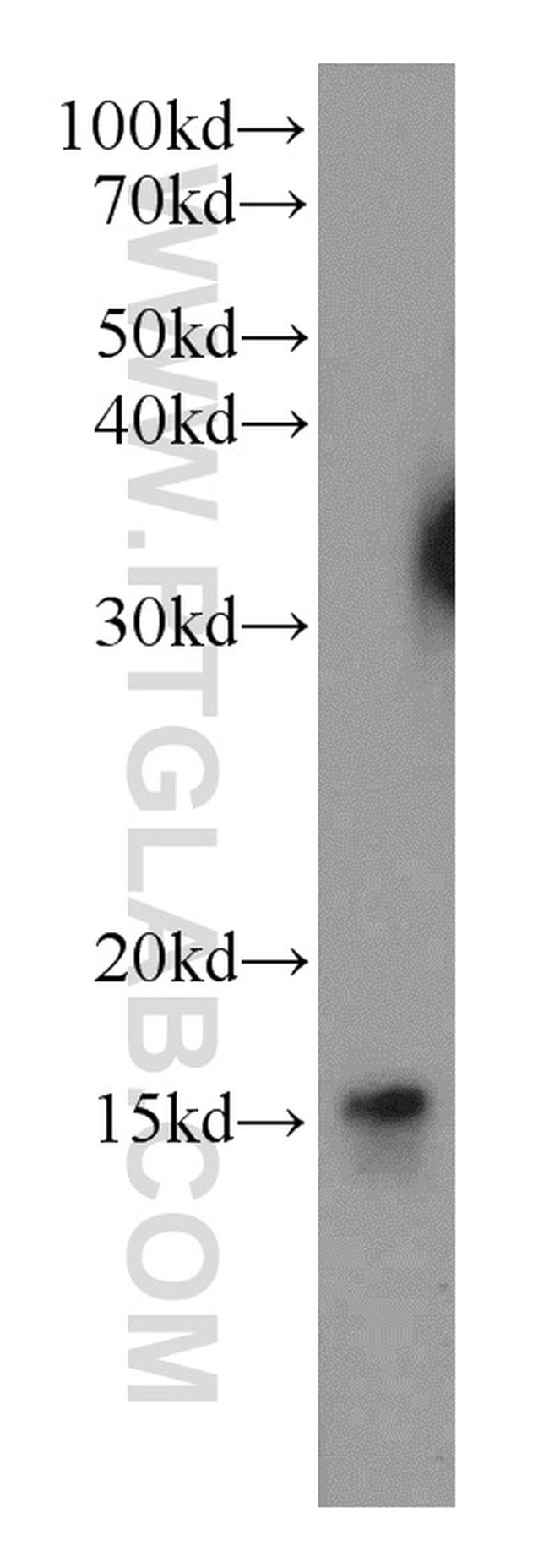 LC3B Antibody in Western Blot (WB)