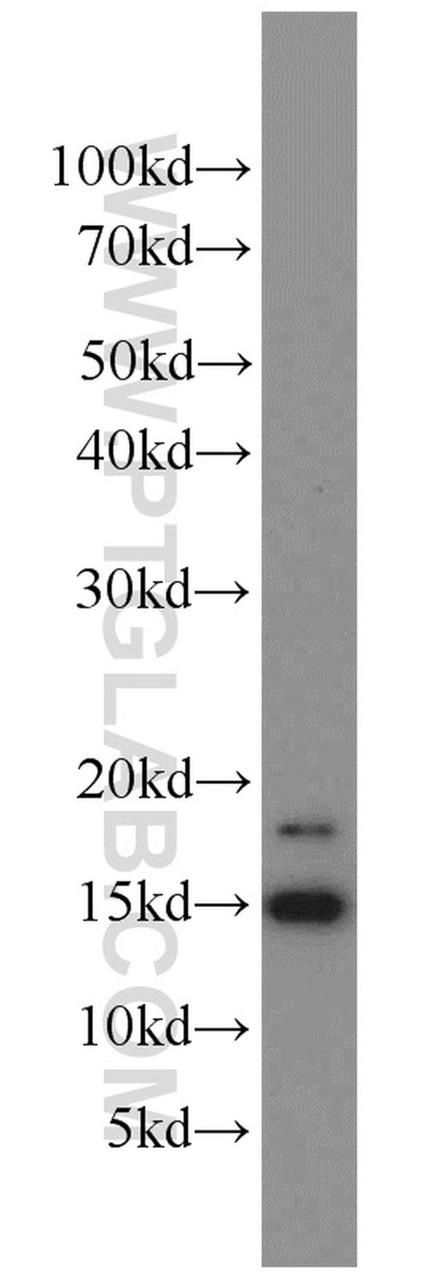 LC3B Antibody in Western Blot (WB)