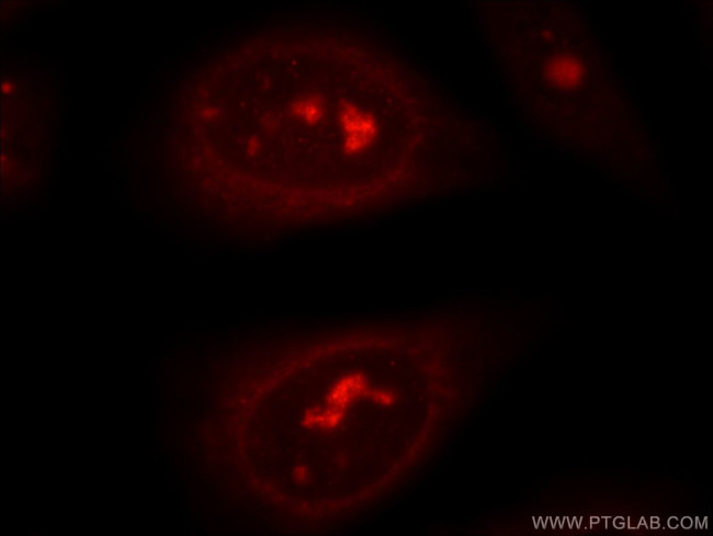 DNA2 Antibody in Immunocytochemistry (ICC/IF)