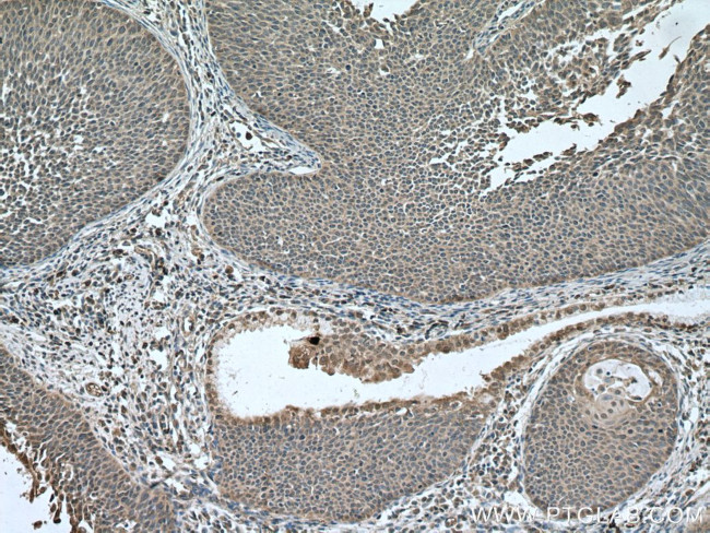 DNA2 Antibody in Immunohistochemistry (Paraffin) (IHC (P))