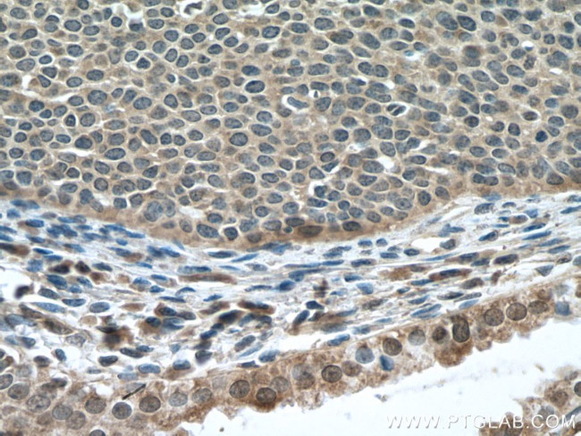 DNA2 Antibody in Immunohistochemistry (Paraffin) (IHC (P))