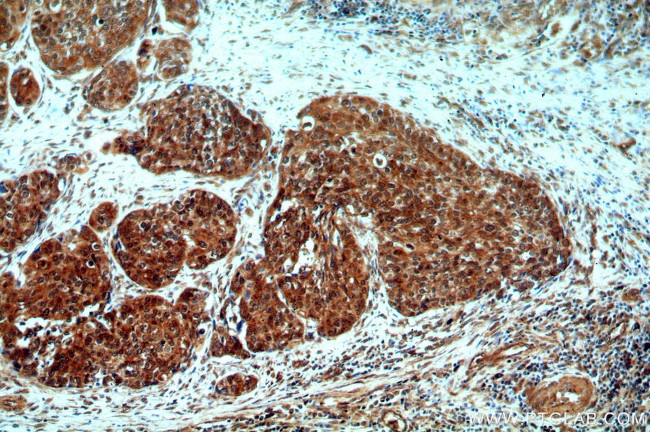 DNA2 Antibody in Immunohistochemistry (Paraffin) (IHC (P))