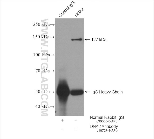 DNA2 Antibody in Immunoprecipitation (IP)