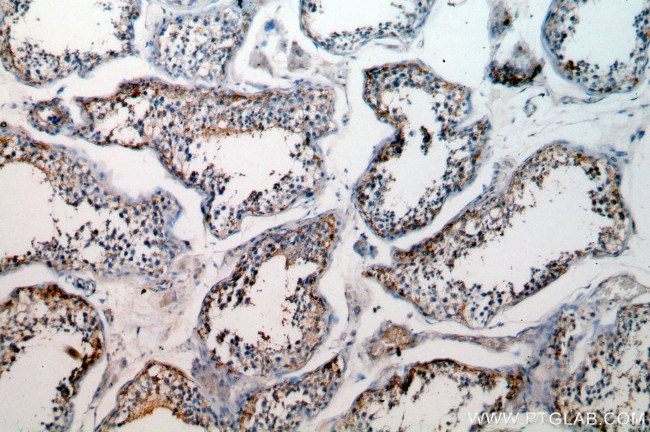 GPX5 Antibody in Immunohistochemistry (Paraffin) (IHC (P))