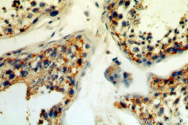 GPX5 Antibody in Immunohistochemistry (Paraffin) (IHC (P))