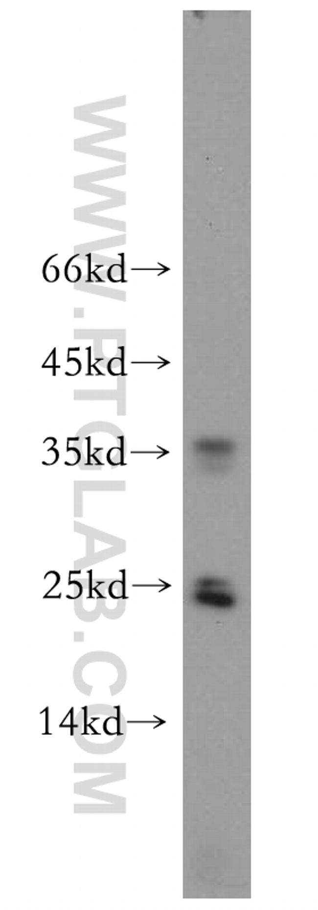 GPX5 Antibody in Western Blot (WB)