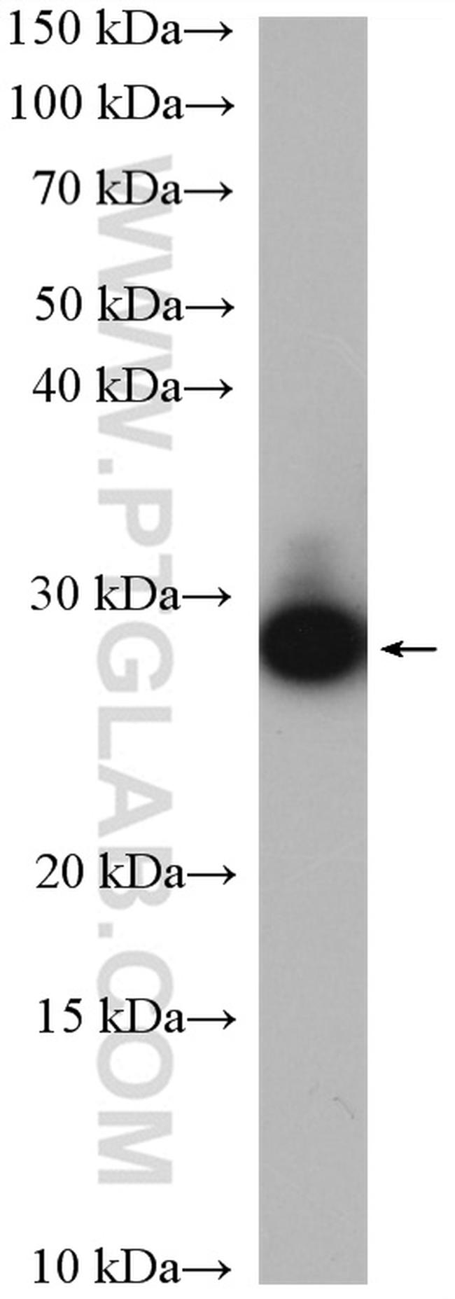 GPX5 Antibody in Western Blot (WB)