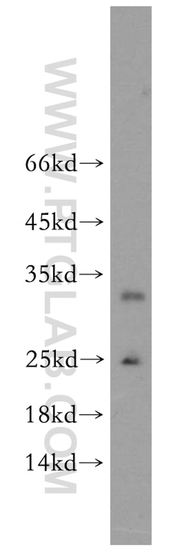 GPX5 Antibody in Western Blot (WB)