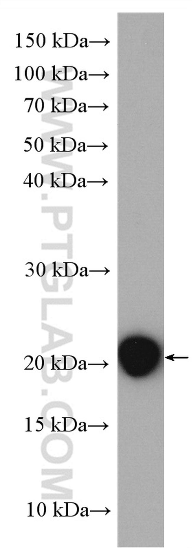 GPX5 Antibody in Western Blot (WB)