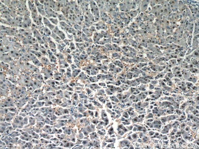 HOXD13 Antibody in Immunohistochemistry (Paraffin) (IHC (P))