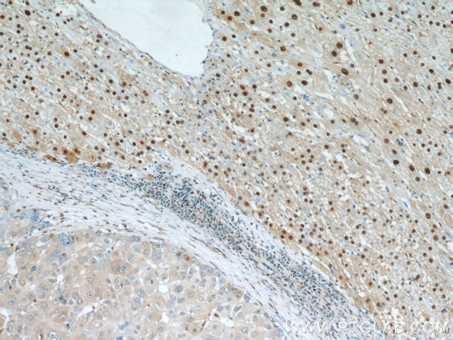 HOXD13 Antibody in Immunohistochemistry (Paraffin) (IHC (P))