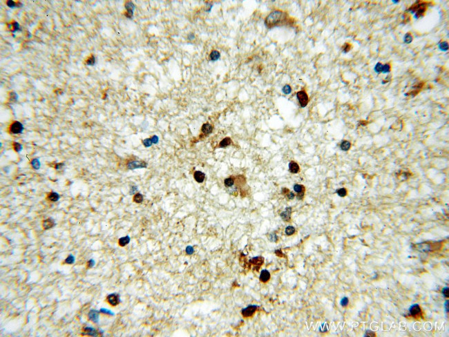 HOXD13 Antibody in Immunohistochemistry (Paraffin) (IHC (P))