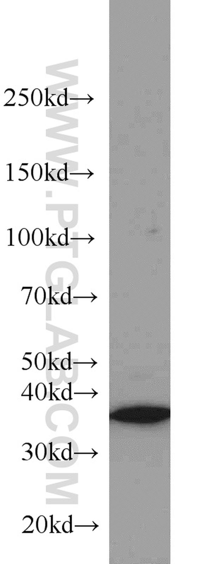 HOXD13 Antibody in Western Blot (WB)