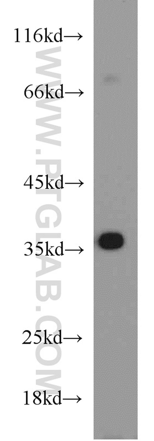 HOXD13 Antibody in Western Blot (WB)