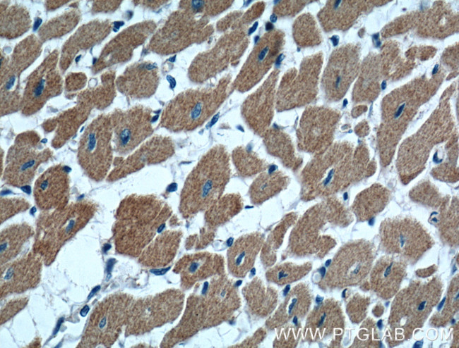 MAPK4 Antibody in Immunohistochemistry (Paraffin) (IHC (P))