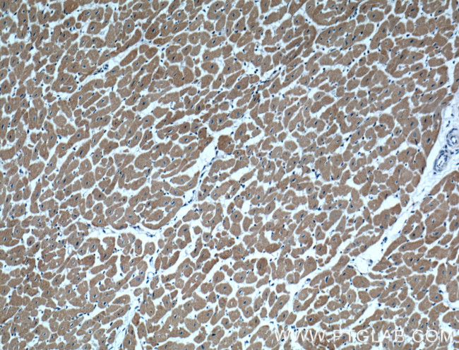 MAPK4 Antibody in Immunohistochemistry (Paraffin) (IHC (P))