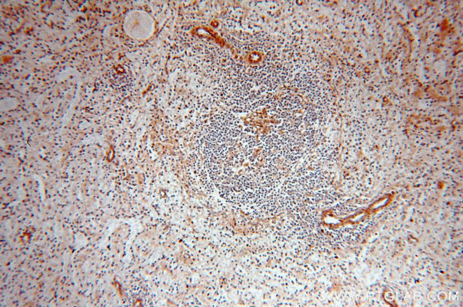 TPPP Antibody in Immunohistochemistry (Paraffin) (IHC (P))