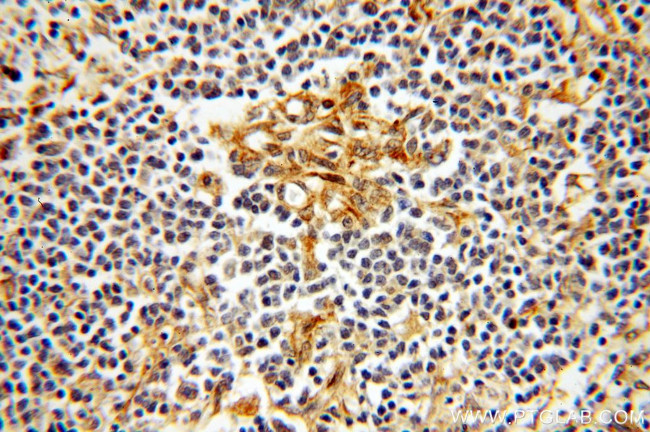 TPPP Antibody in Immunohistochemistry (Paraffin) (IHC (P))