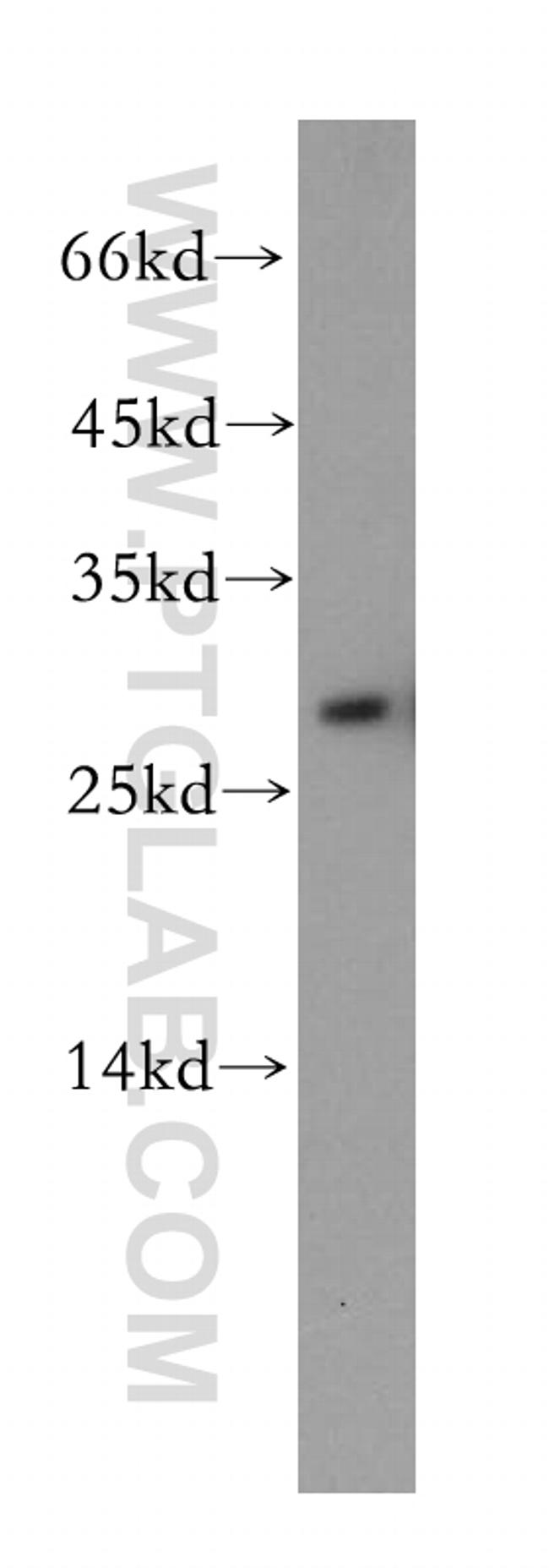 TPPP Antibody in Western Blot (WB)