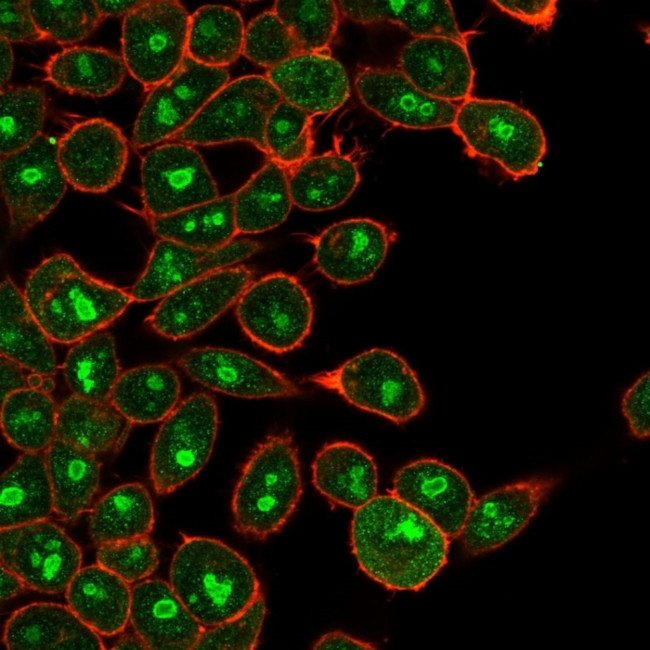 E2F6 Antibody in Immunocytochemistry (ICC/IF)