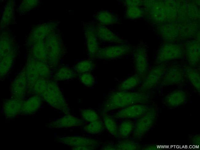 NIPBL Antibody in Immunocytochemistry (ICC/IF)