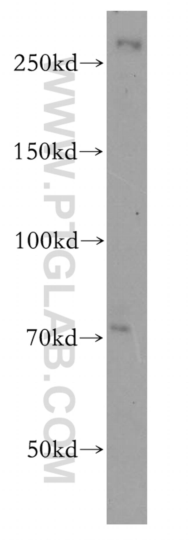 NIPBL Antibody in Western Blot (WB)