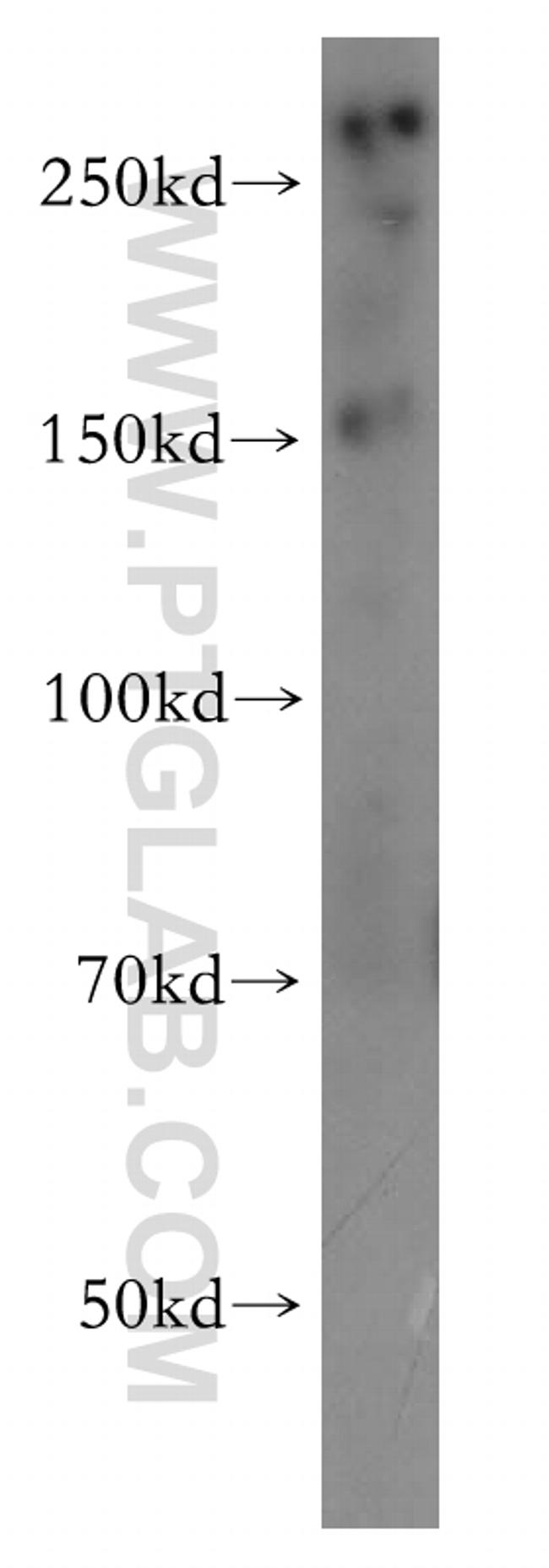 NIPBL Antibody in Western Blot (WB)