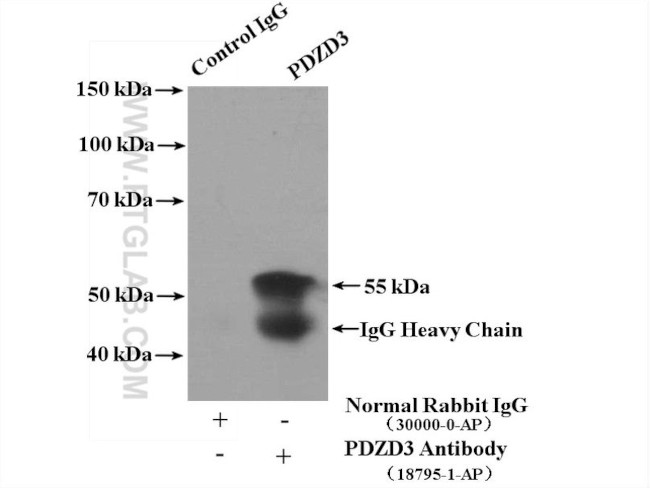 PDZD3 Antibody in Immunoprecipitation (IP)