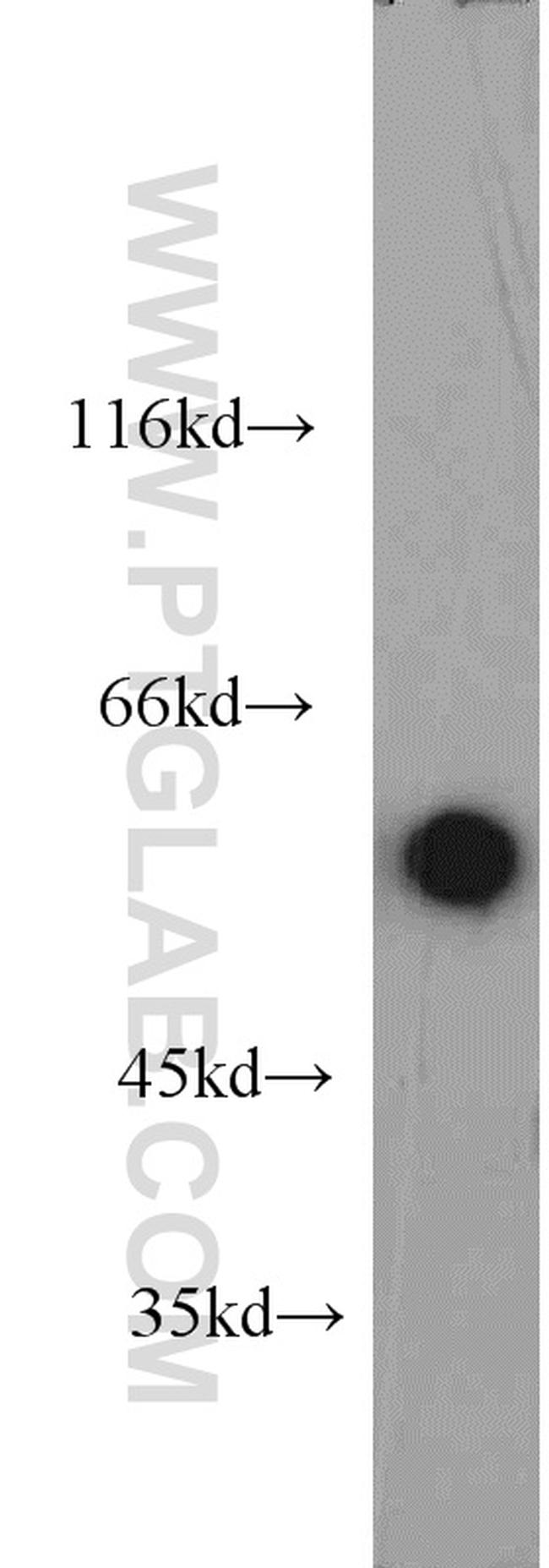 HSF4 Antibody in Western Blot (WB)