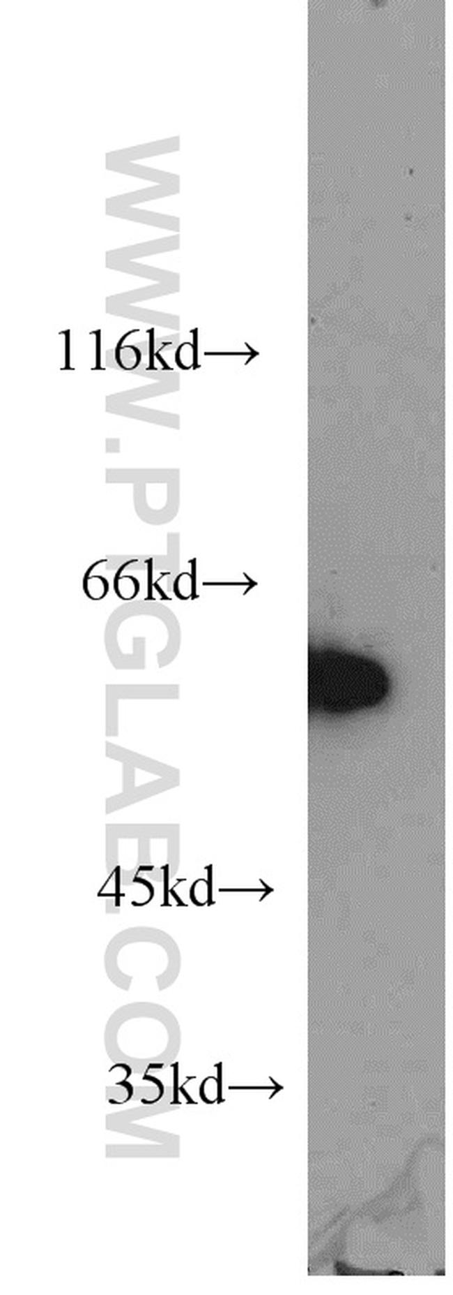 HSF4 Antibody in Western Blot (WB)