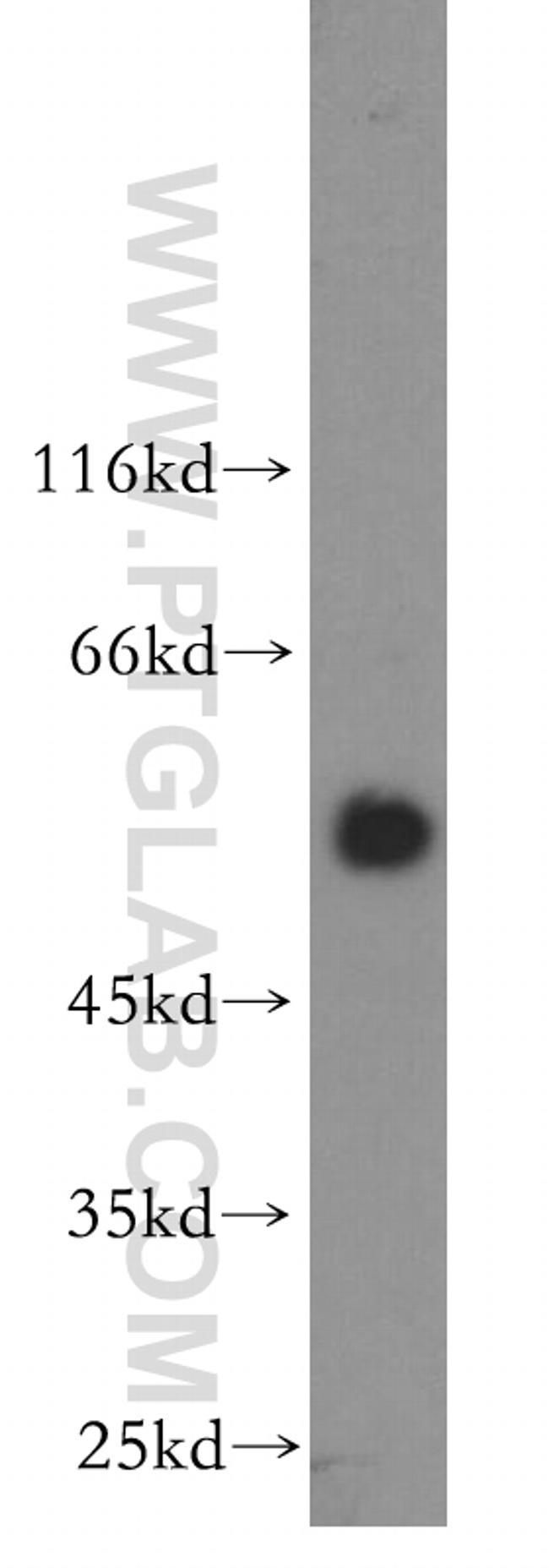 HSF4 Antibody in Western Blot (WB)