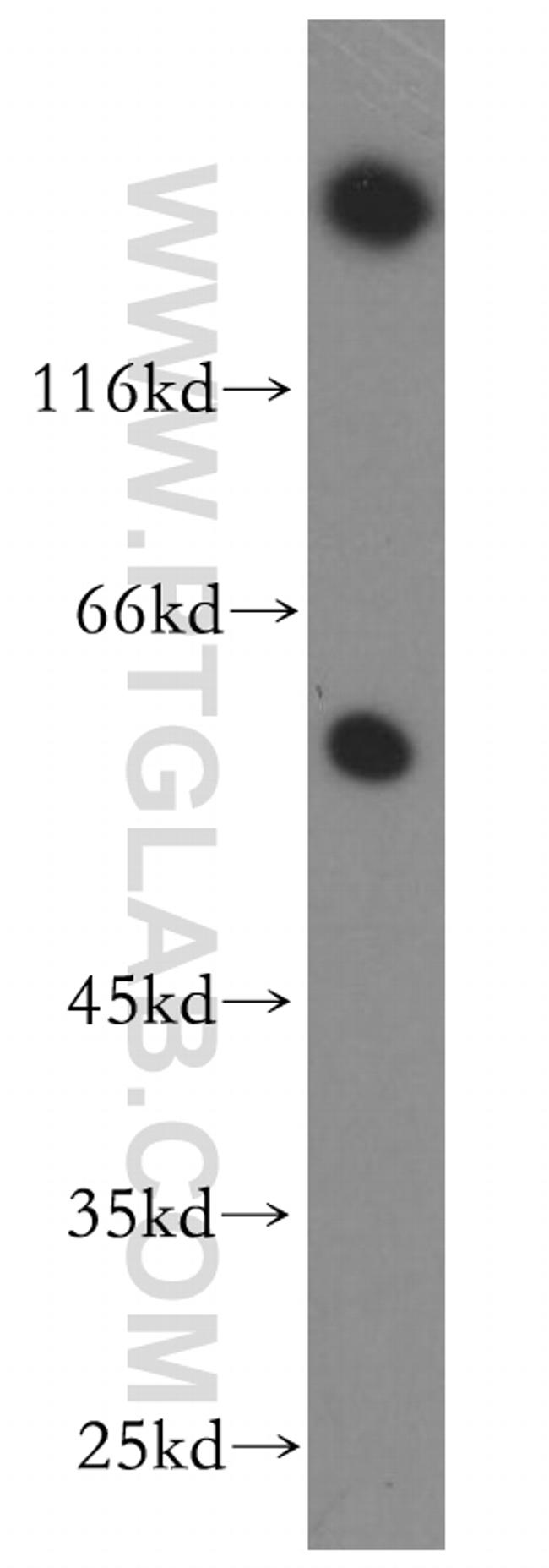 HSF4 Antibody in Western Blot (WB)