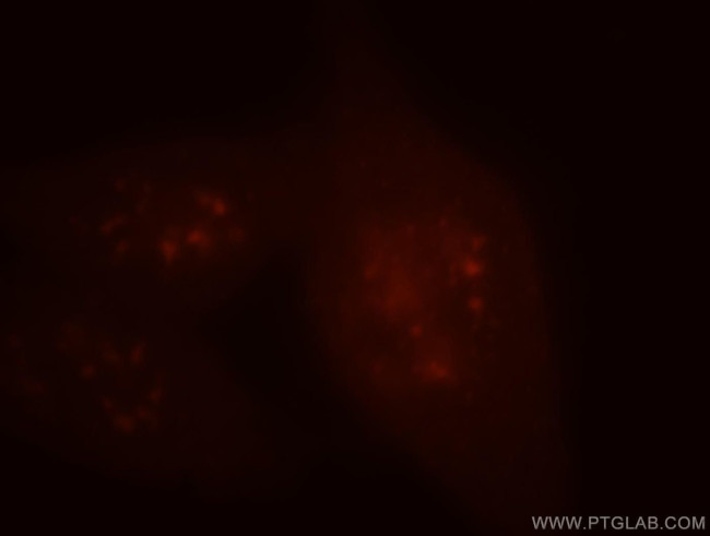 PSME4 Antibody in Immunocytochemistry (ICC/IF)