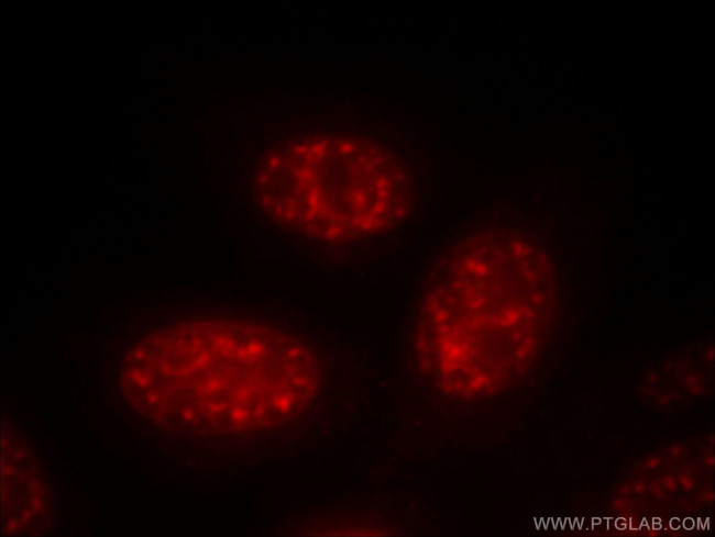 PSME4 Antibody in Immunocytochemistry (ICC/IF)