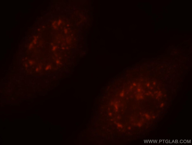 PSME4 Antibody in Immunocytochemistry (ICC/IF)