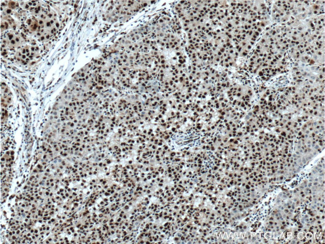 PSME4 Antibody in Immunohistochemistry (Paraffin) (IHC (P))