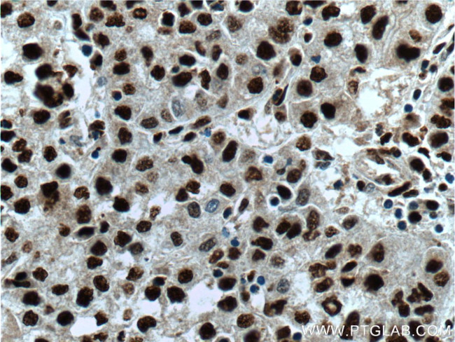 PSME4 Antibody in Immunohistochemistry (Paraffin) (IHC (P))