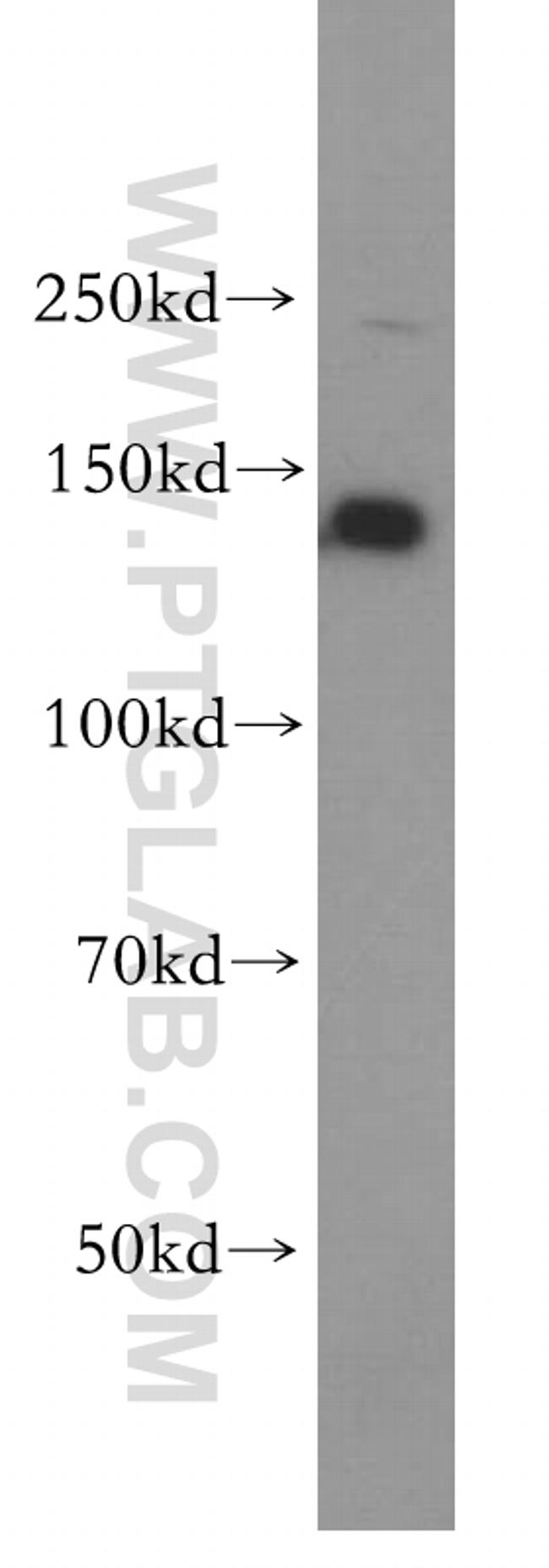 PSME4 Antibody in Western Blot (WB)