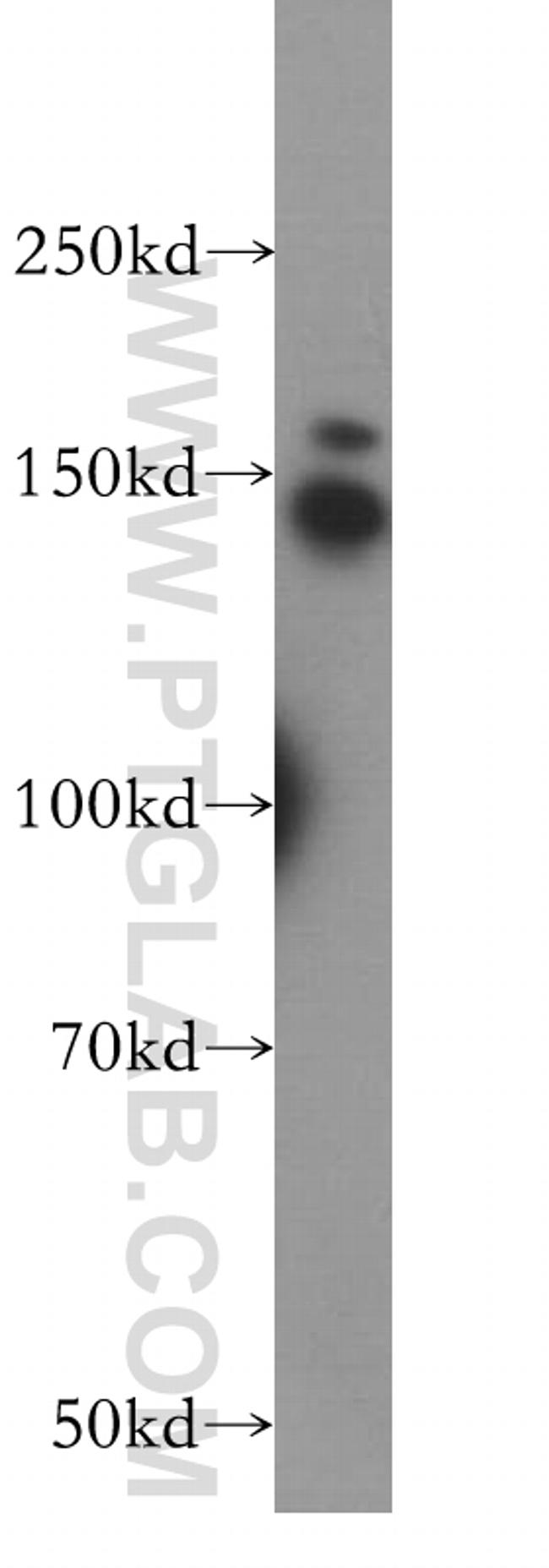 PSME4 Antibody in Western Blot (WB)