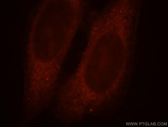 PPP1R9A Antibody in Immunocytochemistry (ICC/IF)