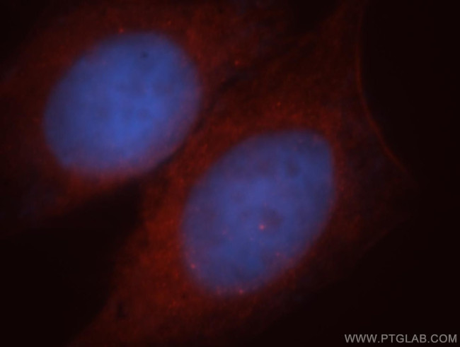 PPP1R9A Antibody in Immunocytochemistry (ICC/IF)