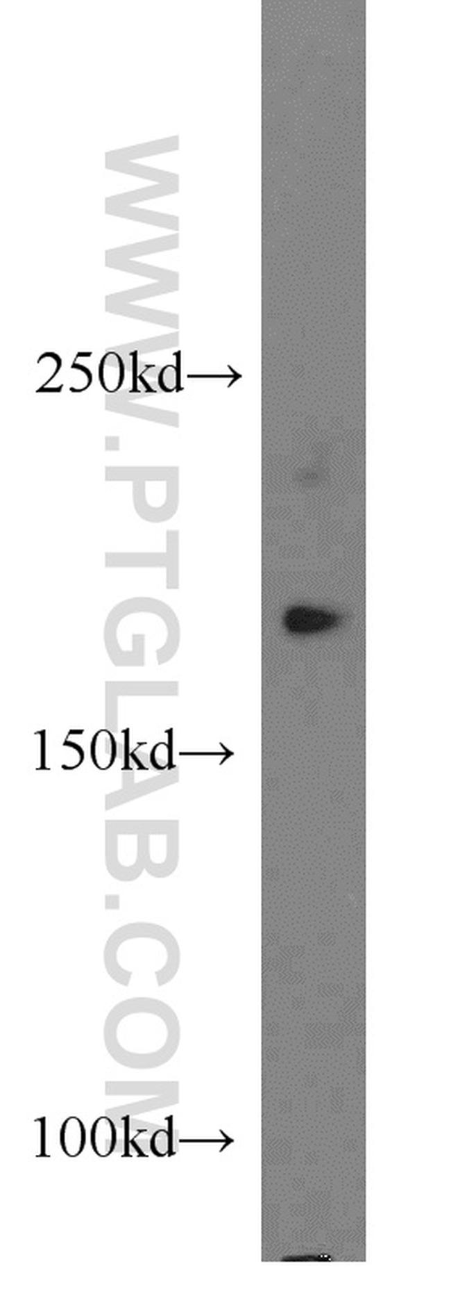 PPP1R9A Antibody in Western Blot (WB)