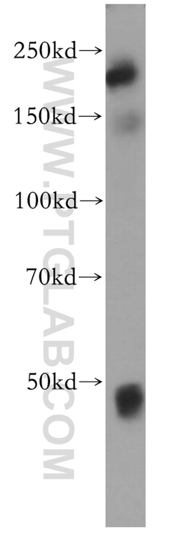 PPP1R9A Antibody in Western Blot (WB)